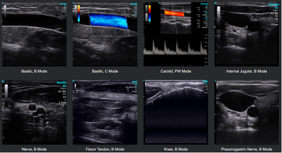 ¿Son precisos los ultrasonidos portátiles? ¿Son precisos los ultrasonidos portátiles?