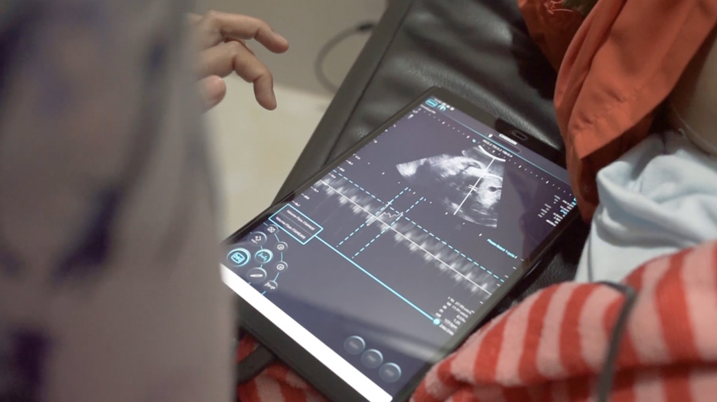 Historia de SonoEye | Viaje de SonoEye con una partera en Indonesia Historia de SonoEye | Viaje de SonoEye con una partera en Indonesia