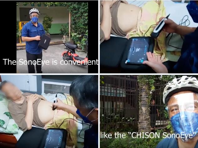 Valor clínico del ultrasonido portátil en Filipinas Valor clínico del ultrasonido portátil en Filipinas