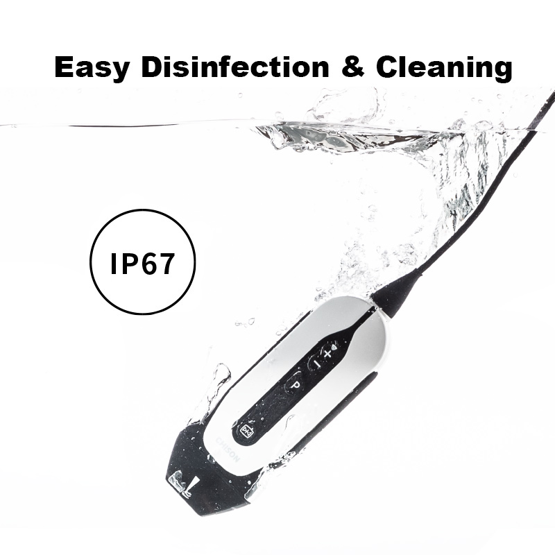 Handheld Ultrasound SonoEye P1