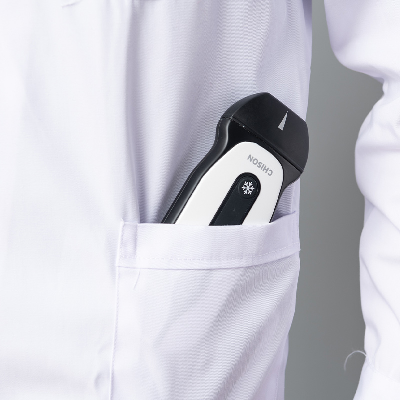 Handheld Ultrasound SonoEye P1