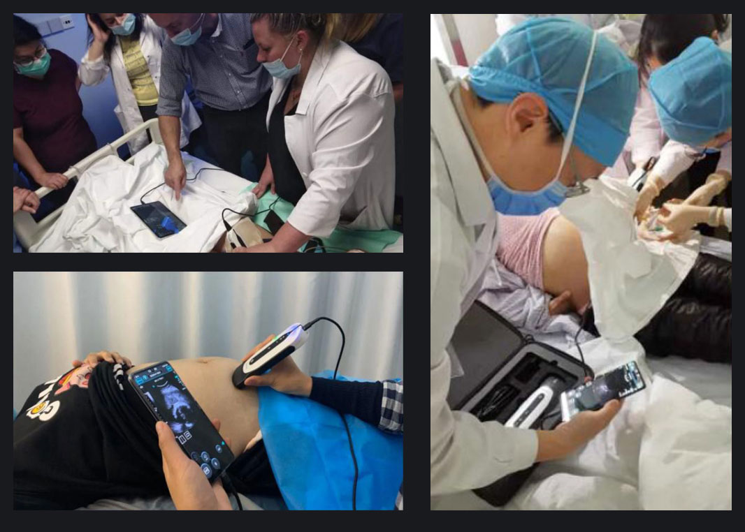 La visión de CHISON SonoEye para potenciar la salud de las mujeres. La visión de CHISON SonoEye para potenciar la salud de las mujeres.