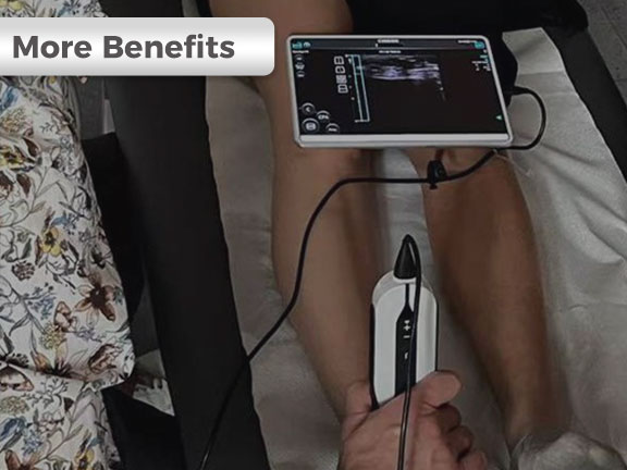 Por qué necesitará un ultrasonido portátil