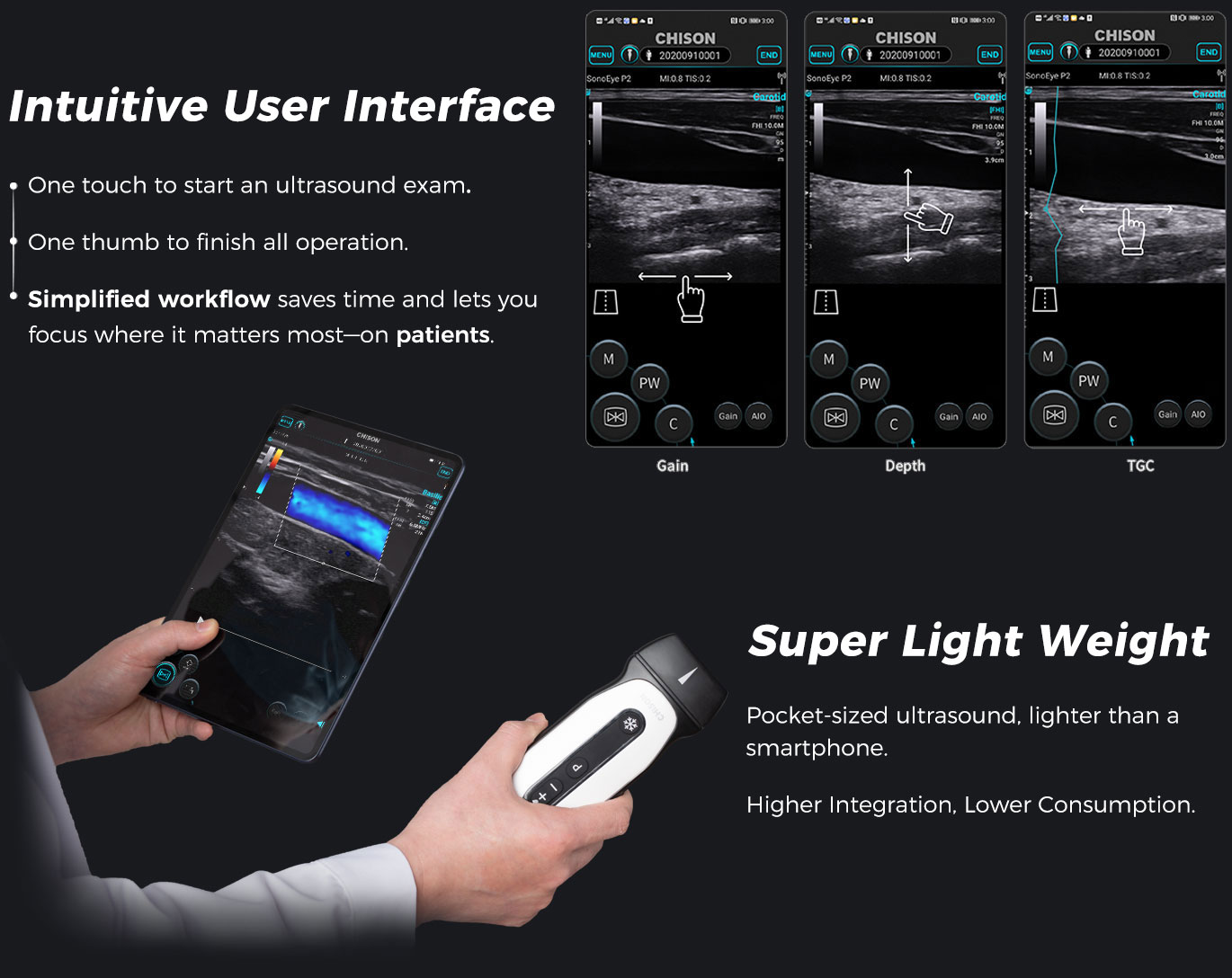 SonoEye P2 SonoEye P2