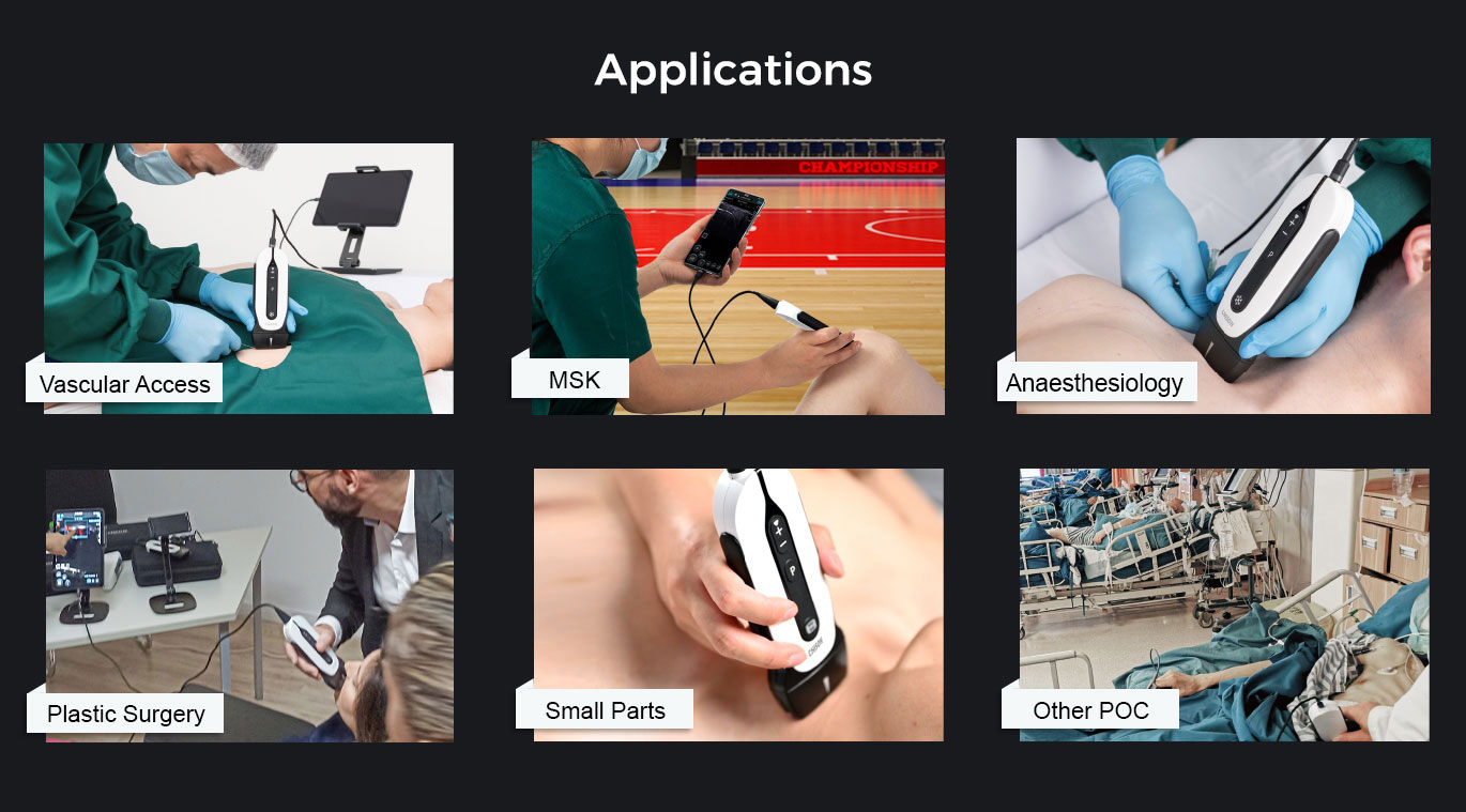 SonoEye P1 SonoEye P1