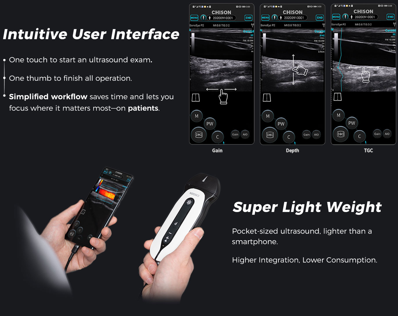 SonoEye P1 SonoEye P1