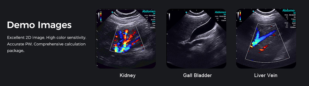 索诺眼P6 索诺眼P6