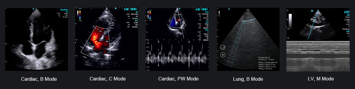索诺眼P3 索诺眼P3