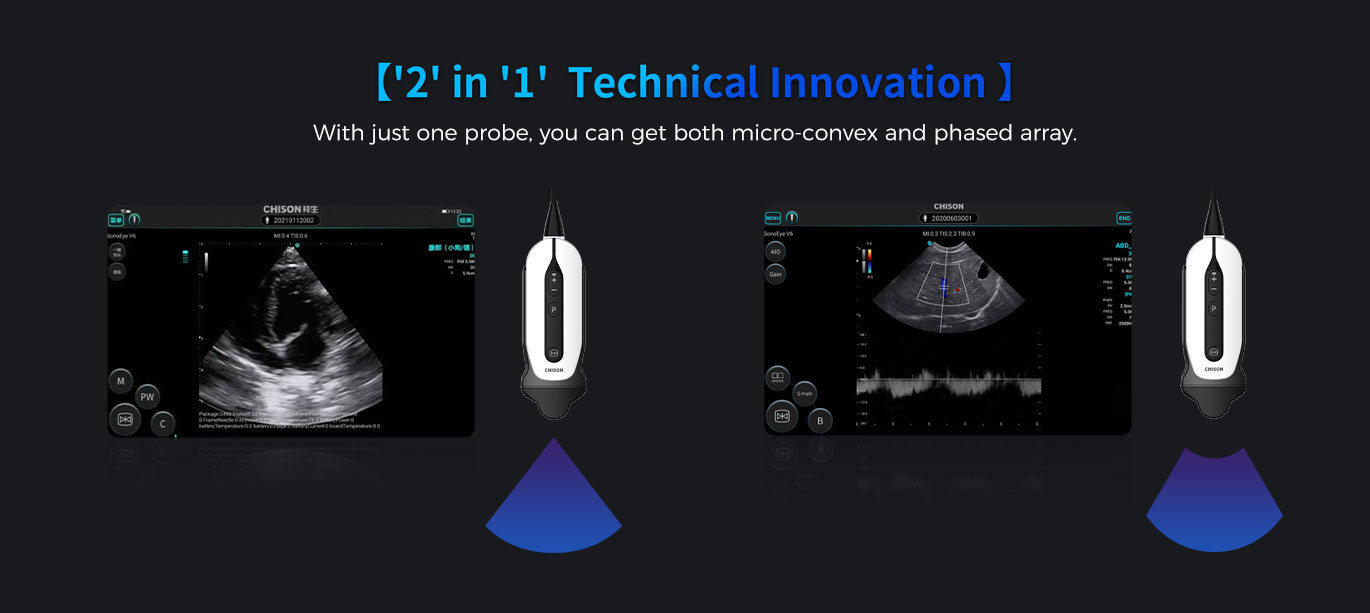 索诺眼P6 索诺眼P6