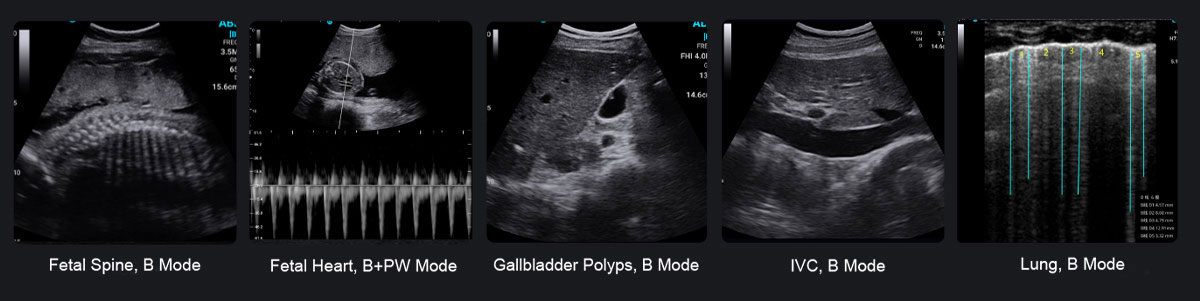 索诺眼P5 索诺眼P5