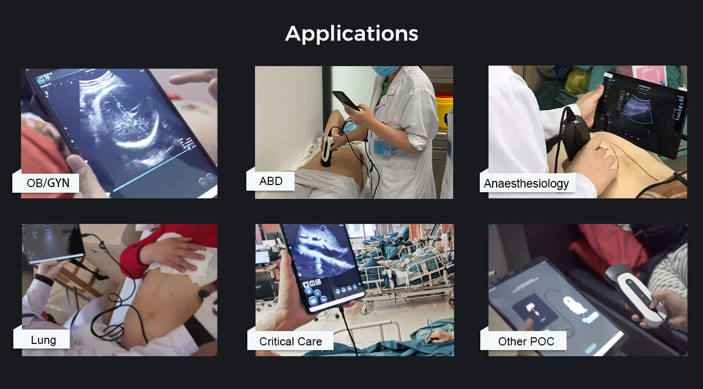 索诺眼P5 索诺眼P5