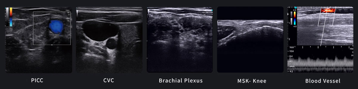 SonoEye P1 SonoEye P1