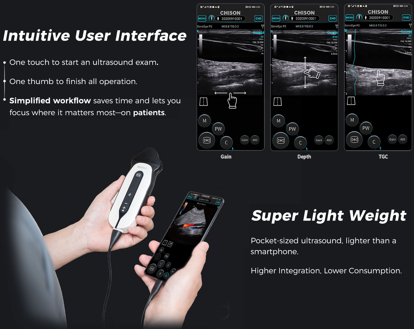 SonoEye P6 VET SonoEye P6 VET