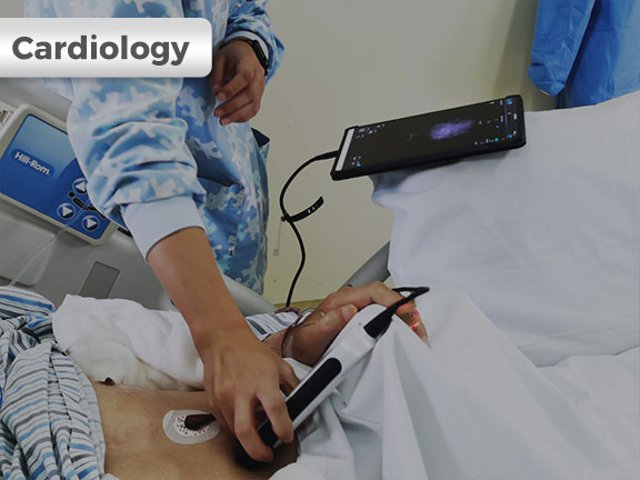 SonoEye 在心脏应用中