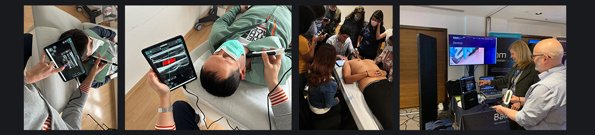 SonoEye 在血管超声中的应用 SonoEye 在血管超声中的应用