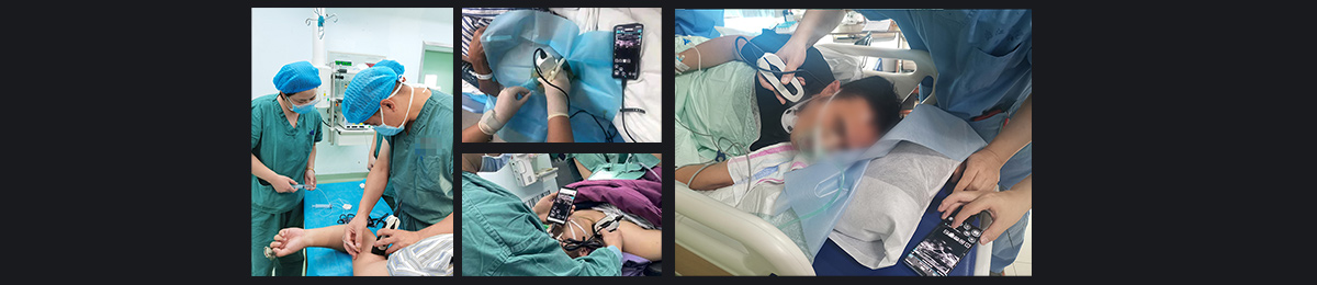 SonoEye 在麻醉中的应用