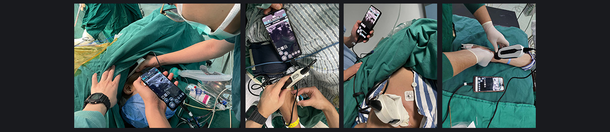 SonoEye 在麻醉中的应用