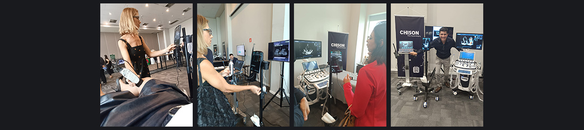 SonoEye 日报 |最近的活动和更新 SonoEye 日报 |最近的活动和更新