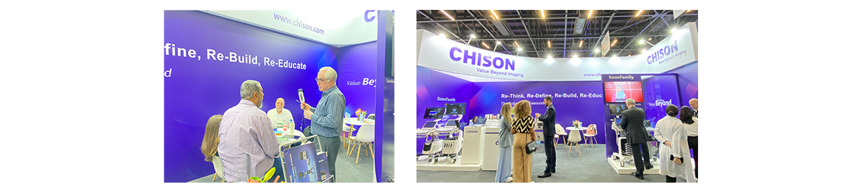  Capturando momentos preciosos con SonoEye en Hospitalar 2024