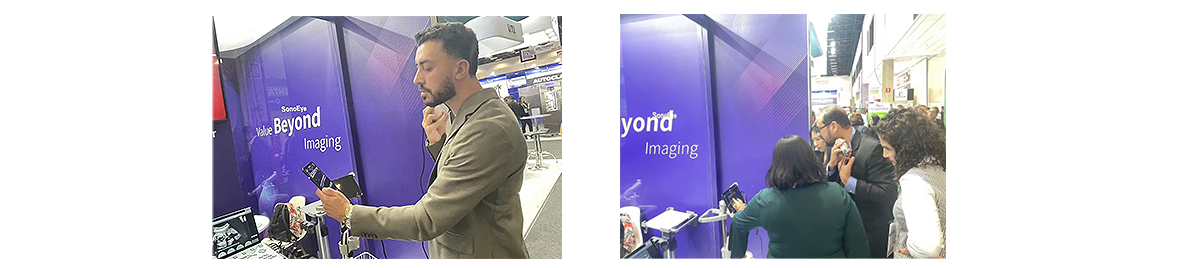  Capturando momentos preciosos con SonoEye en Hospitalar 2024