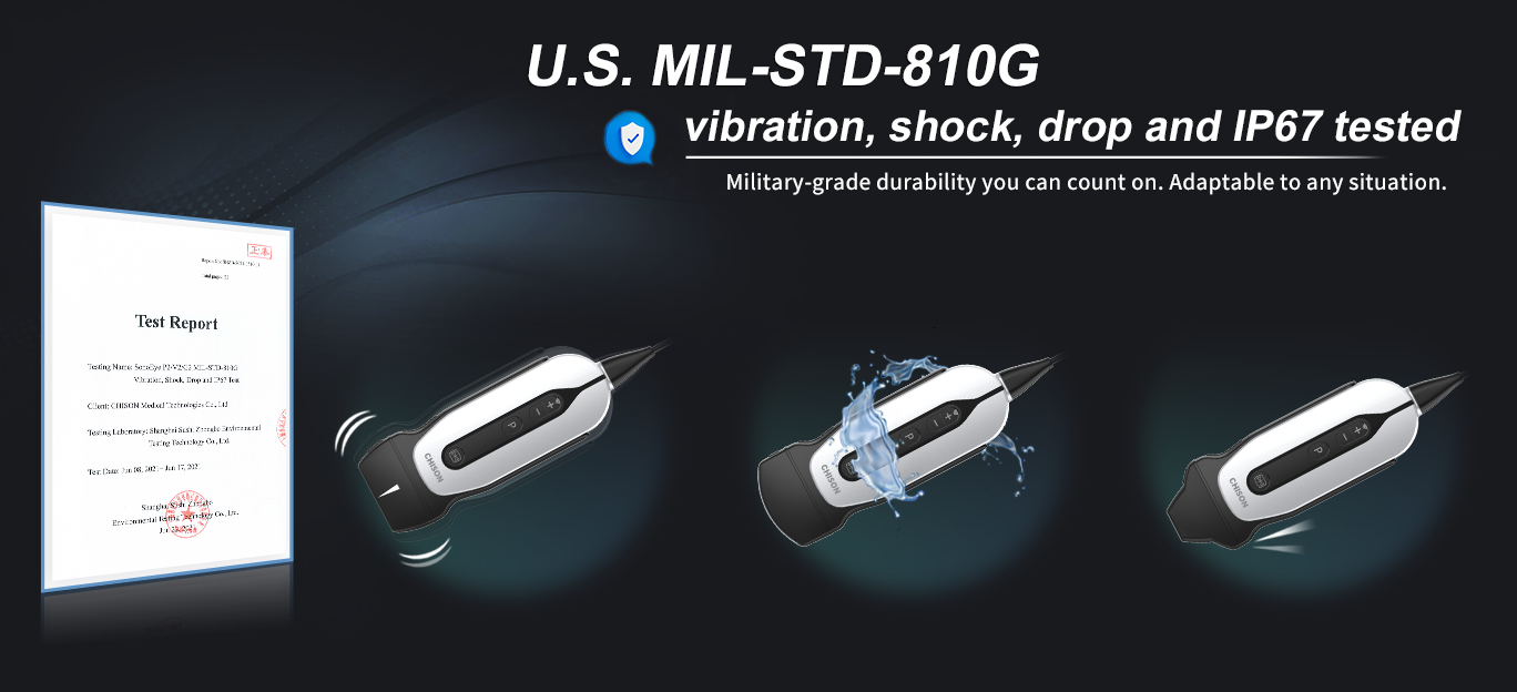 在 FIME 2024 上探索 SonoEye:用于 POCUS 的高级手持式超声 在 FIME 2024 上探索 SonoEye:用于 POCUS 的高级手持式超声