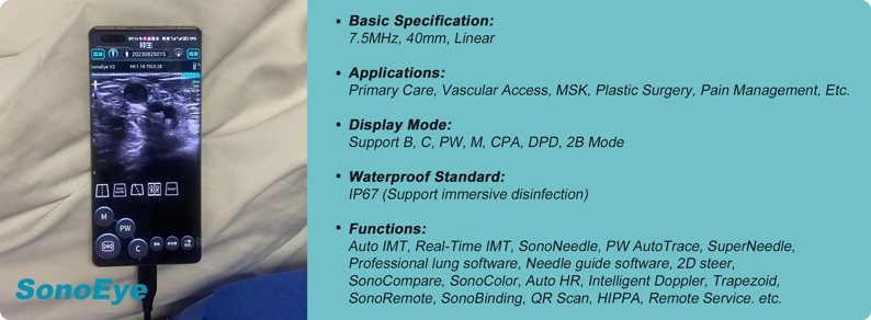 Enhancing Clinical Efficiency and Patient Safety with Handheld Ultrasound and Mini-Midline Catheters Enhancing Clinical Efficiency and Patient Safety with Handheld Ultrasound and Mini-Midline Catheters