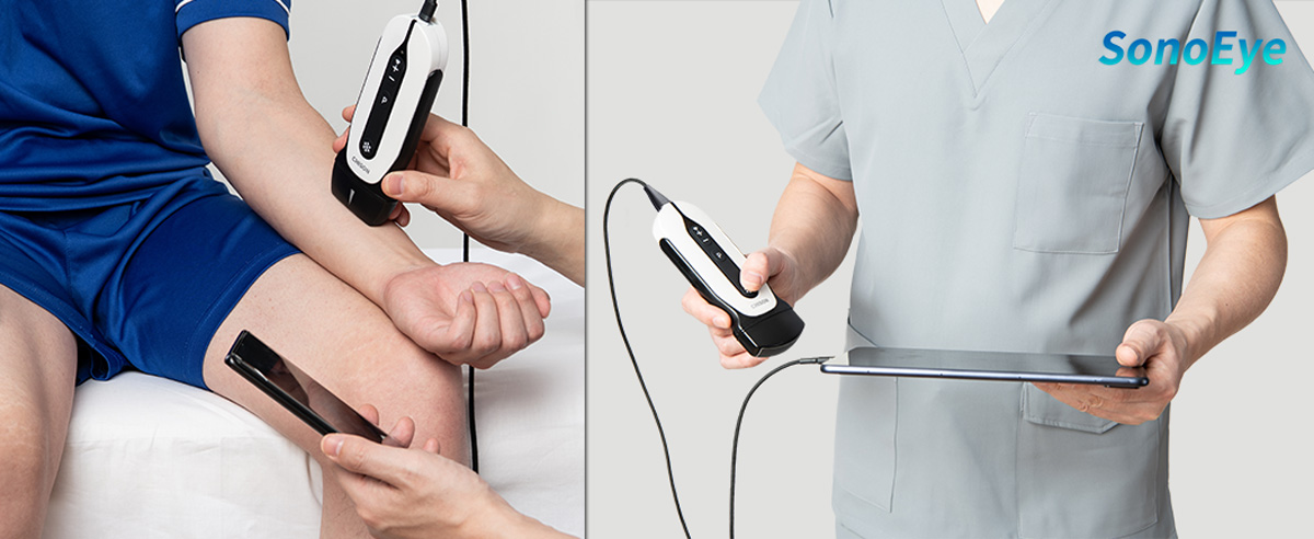 Utilizing Handheld Ultrasound for MSK Case Studies