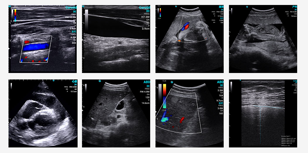 Authoritative Findings: SonoEye Hailed as Premier Ultrasound Device Authoritative Findings: SonoEye Hailed as Premier Ultrasound Device