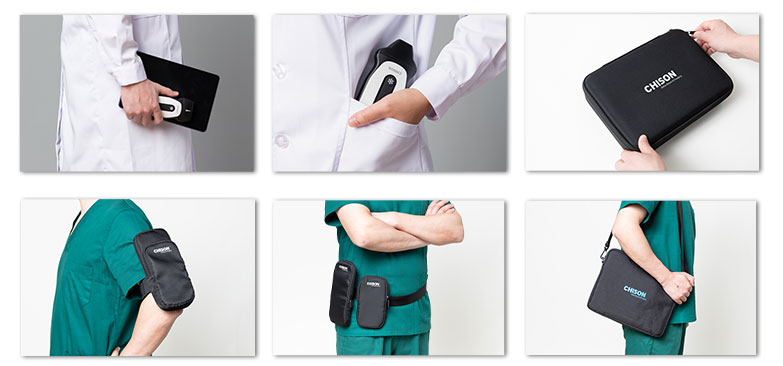 Ultra-Portability Authoritative Findings: SonoEye Hailed as Premier Ultrasound Device