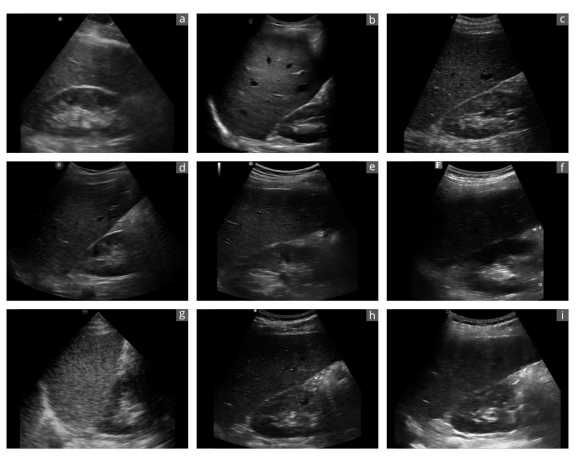 Exemplary sonographic images Authoritative Findings: SonoEye Hailed as Premier Ultrasound Device