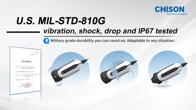 Bringing Care to the Unreachable: SonoEye in Action Bringing Care to the Unreachable: SonoEye in Action
