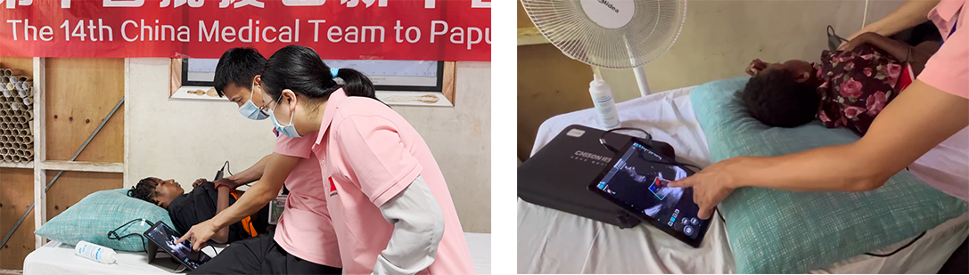 Bringing Care to the Unreachable: SonoEye in Action Bringing Care to the Unreachable: SonoEye in Action